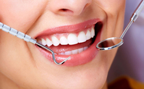  Invisalign-Treatment-Etobicoke