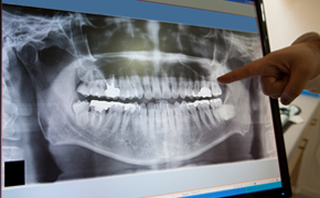  Digital Radiography