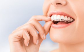  Invisalign-Treatment-Etobicoke