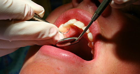 Root Canal Treatment