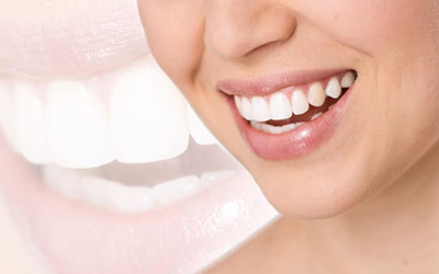 5 Oral Health Care Tips To Protect Your Teeth